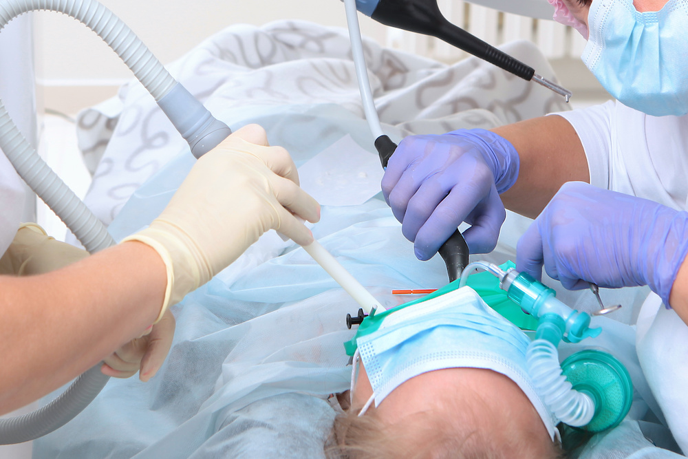 pediatric dental general anesthesia